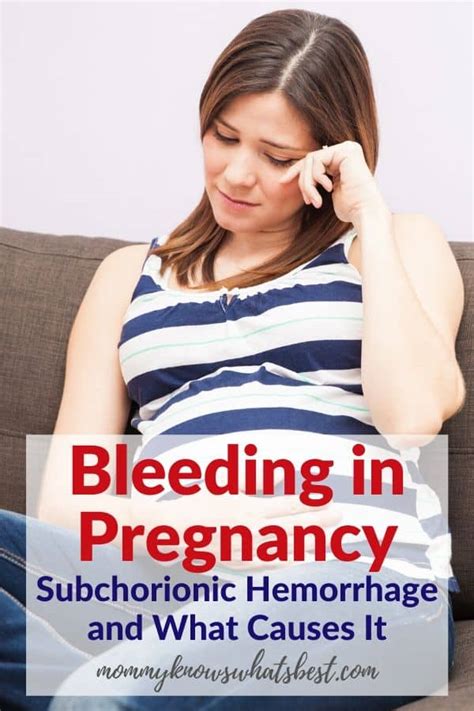 What Causes Subchorionic Hemorrhage In Pregnancy Can It Be Treated