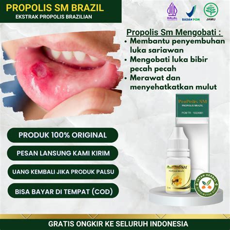 Jual Propolis Sm Ml Obat Tetes Sariawan Di Bibir Sariawan Menahun