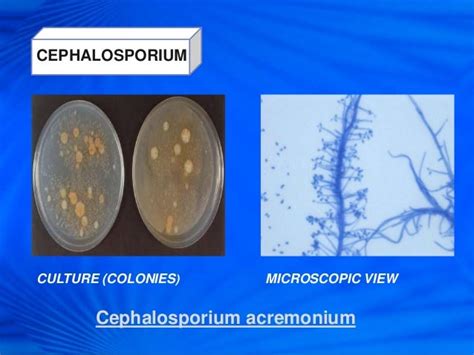 Cephalosporins