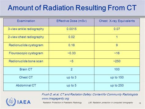 Ct Scan Radiation Dose Chart - Ponasa