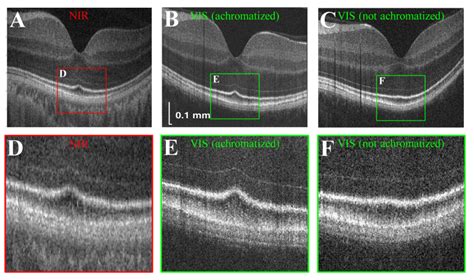 Ultrahigh Resolution Retinal Imaging By Visible Light Oct With