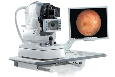 RetinopatÍa DiabÉtica Averclaro Clínica Oftalmológica