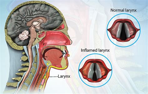 Health Condition Symptoms Causes Treatment And More