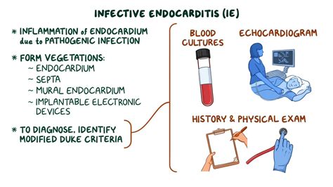 Infectious Endocarditis Clinical Sciences Osmosis Video Library