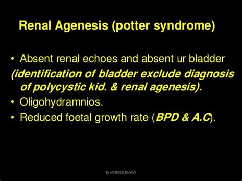 10 Fetal Urinary Tract Dr Ahmed Esawy