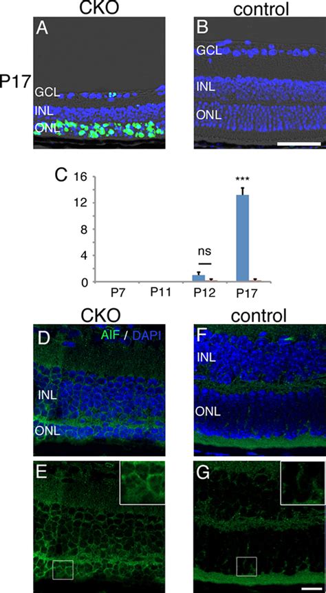 Tunel Positive Cells And Nuclear Translocation Of Aif In Photoreceptor