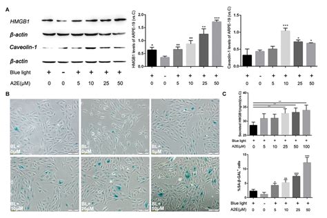 HMGB1 And Caveolin 1 Related To RPE Cell Senescence In Age Related