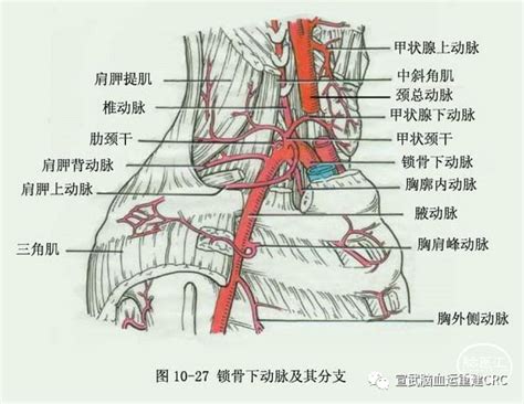 锁骨下动脉盗血综合征 脑医汇 神外资讯 神介资讯