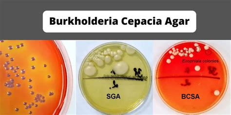 Burkholderia Cepacia Agar Base Preparation Composition Principle