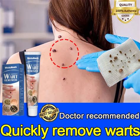 20g Original Wart Removal Ointment Fast Remove Skin Tag Remover