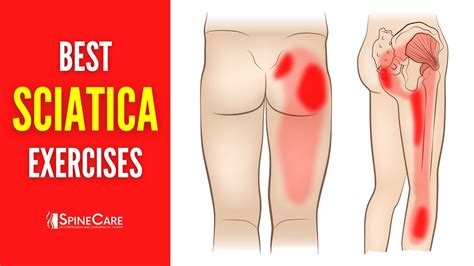 The Best Sciatica Exercises For NO MORE PAIN YouTube