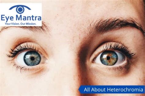 Heterochromia- Types, Causes, Diagnosis, Remedies And Treatment