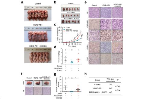 Hoxd3 Is Required For The Hoxd As1 Mediated Progress Of Crc In Vivo