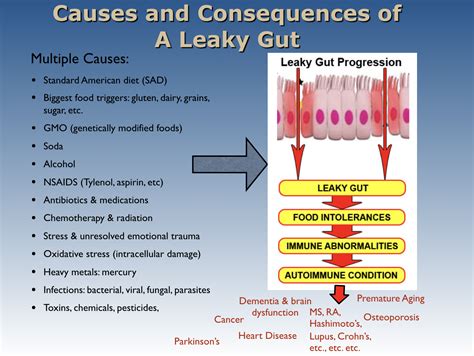 Foods That Cause Leaky Gut