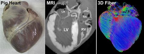 cardiac fibers  pig hearts quantitative bioimaging laboratory