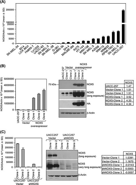 NOX5 Expression In Human Melanoma Cell Lines Total RNA Was Extracted