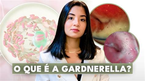 Gardnerella No Homem Fotos