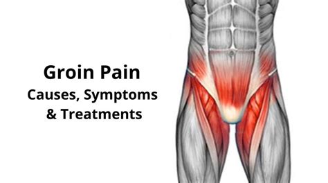 Groin Pain And Swollen Lymph Nodes Causes