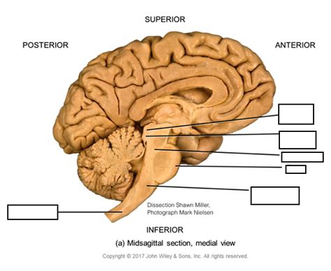 Brain stem Diagram | Quizlet