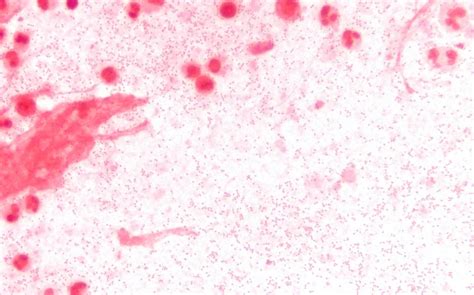 Haemophilus Influenzae Encyclopedia MDPI