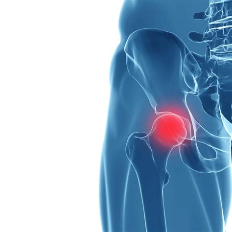 Hip Arthroscopy » Las Vegas Orthopedic Surgeons - Bone & Joint Specialists