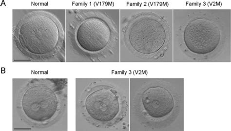 Mutation Analysis Of The Tubb8 Gene In Nine Infertile Women With Oocyte Maturation Arrest