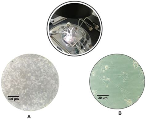 An Inverted Microscopic Image Of The Adherence Of The Mcf 7 Cells In Download Scientific