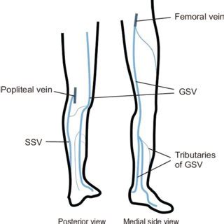 Ascending Routes Of Great Saphenous Vein Gsv And Short Saphenous Vein