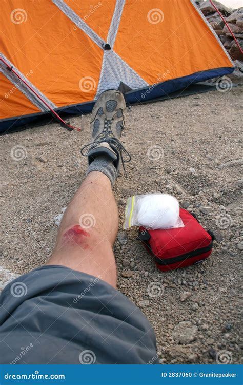 Climbing Injury Stock Photo Image Of Outdoors Hiker 2837060