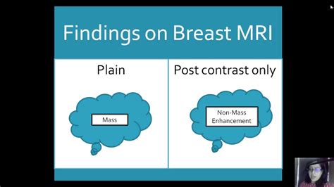 The How Why When And What Of Breast Mri Youtube