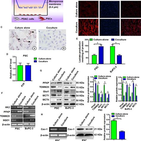 Stromatumour Cell Metabolic Coupling Occurs Under PSC And PDAC