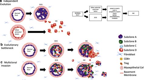 Hypothetical Models Of Invasion Of Ductal Carcinoma In Situ Dcis A