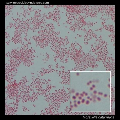 Moraxella. Gram stain and cell morphology. Moraxella micrograph ...