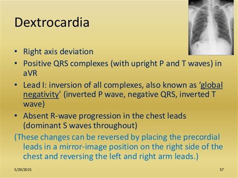 Role Of Ecg In Pulmonology