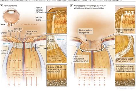 Abducens Nerve Diseases | Semantic Scholar