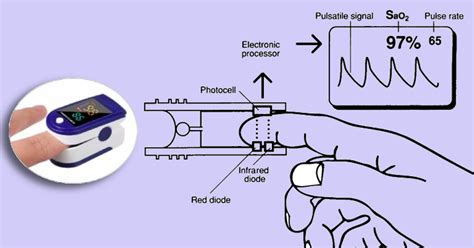 Pulse Oximetry: Factors Impacting Accuracy