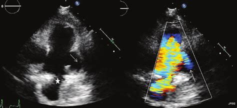 A Two Dimensional Transthoracic Echocardiography Showed The Patent Download Scientific