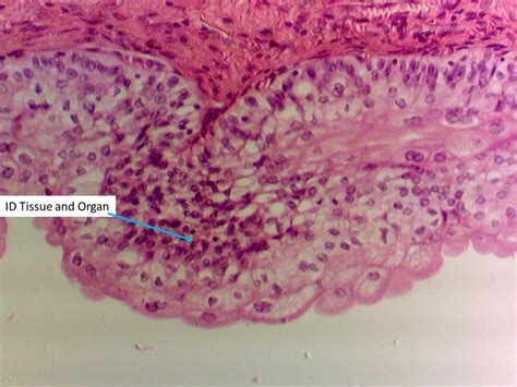 Transitional Epithelium Labeled 400x