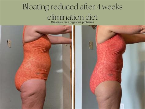 Diastasis Recti Bloating Core Fitness For Moms