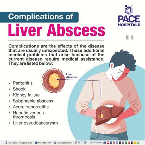 Liver Abscess Causes Symptoms Prevention Treatment