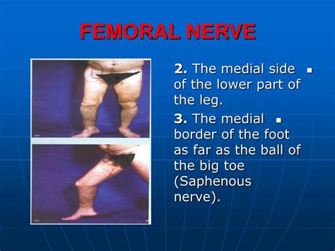 PPT - FEMORAL NERVE INJURY PowerPoint Presentation - ID:472761