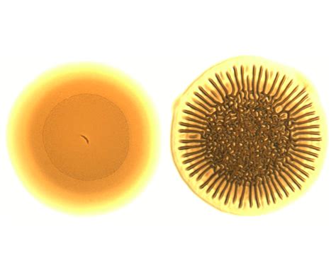 Scientists Warm Up to Vibrio Cholerae’s Temperature Adaptation