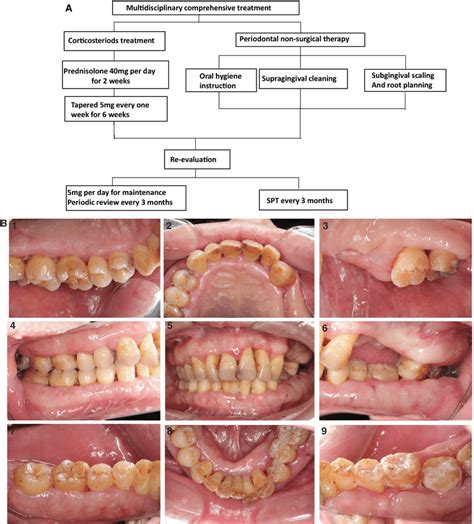 A Multidisciplinary Comprehensive Treatment Approach With Download