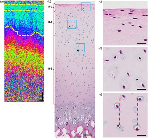 Comparison Of Ps Oct With Histology A Ps Oct Phase Retardation Image