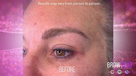 Before And After Treatment Microblading By BrowBeat Studio Dallas YouTube