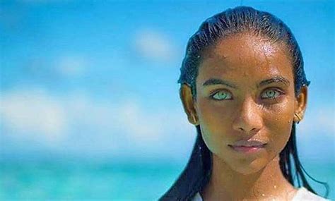 Los Ojos Mas Bonitos Del Mundo En Fotos Discapacidad Visual