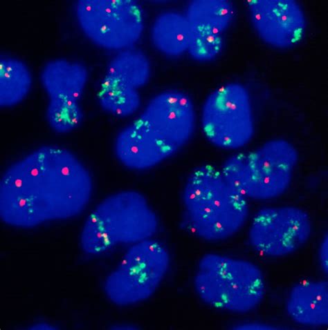 Terc Red And Chromosome Centromere Green Fish Probe Histoline