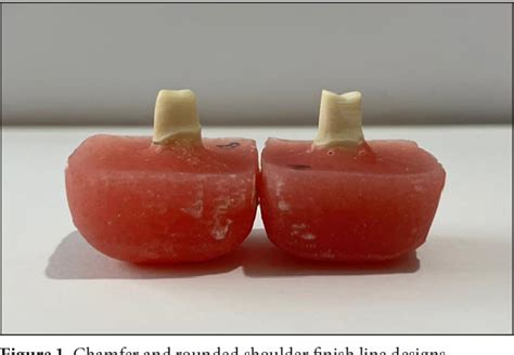 Figure From Evaluation Of The Marginal Fit Of Finish Line Designs Of