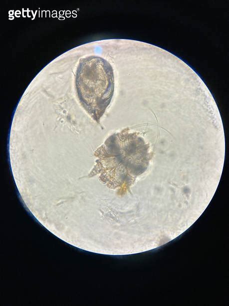 Notoedres Cati Under The Microscope Notoedric Mange Also Referred To As Feline Scabies 이미지