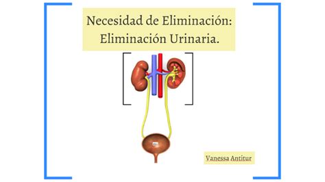 NECESIDAD DE ELIMINAR By Vanessa Javiera On Prezi